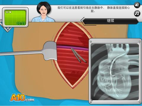 起搏器手术